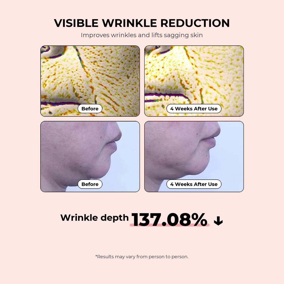 Visible wrinkle reduction: skin scans and profile photos before and after 4 weeks of use