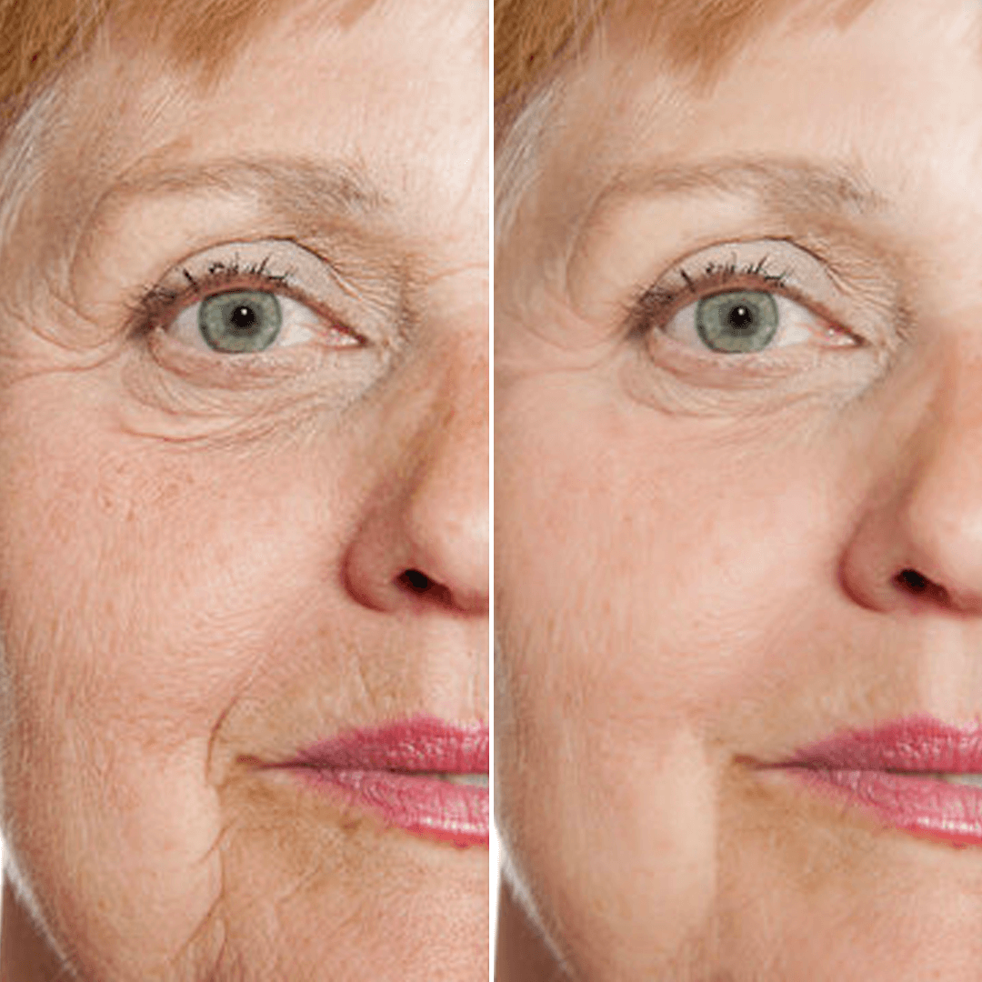 Rejuvenate Gesichtsserum