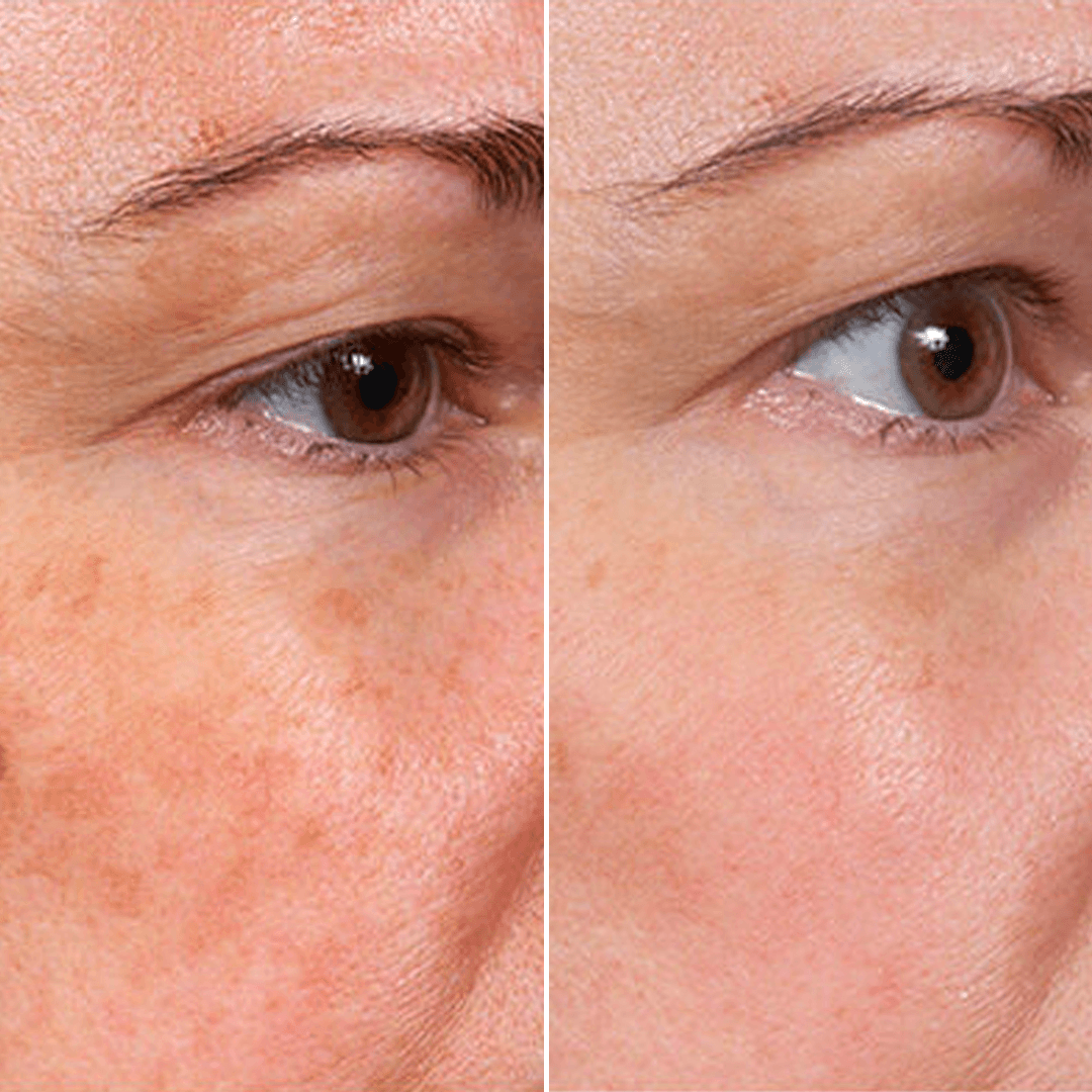 Rejuvenate Gesichtsserum